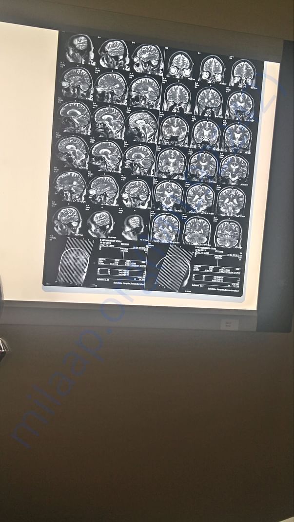 Mri copy