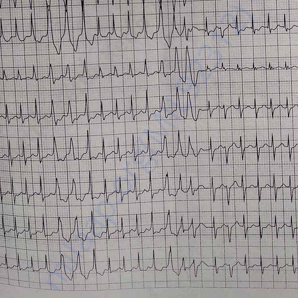 Medical Report