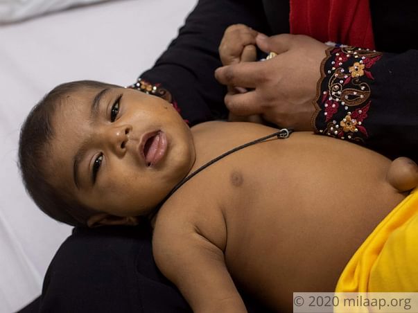 Misam Mohammed needs your help to undergo Liver Transplant