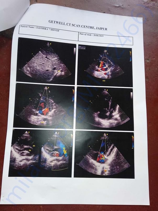 CT Scan of Swastika taken on 26/06/19