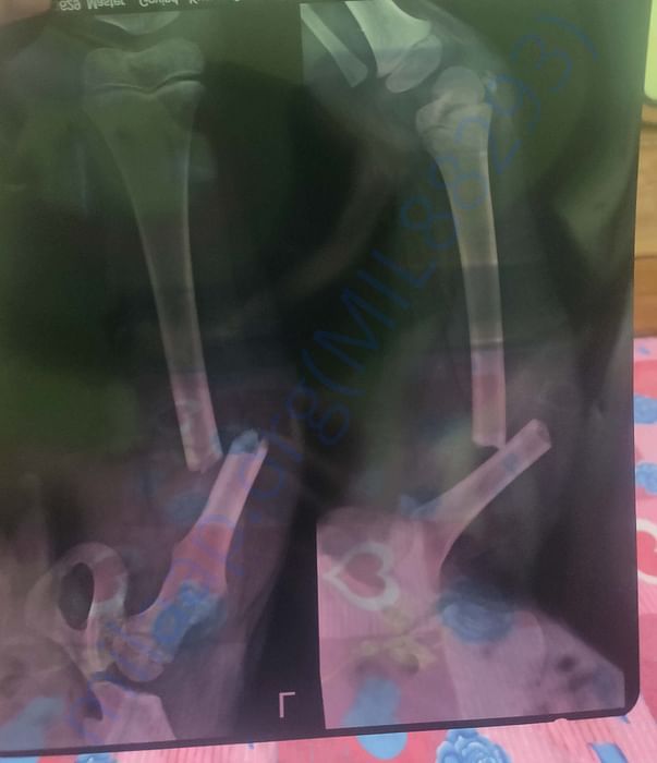 My 8-Year-Old Son May Never Be Able To Walk Again If He Doesn’t Receiv