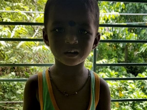 DAUGHTERS.ILLTREATED BY FAMILY SUFFERING FROM MALNUTRITION AND DAMAGE