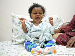 Help Baby Fight Lekana Hepatoblastoma