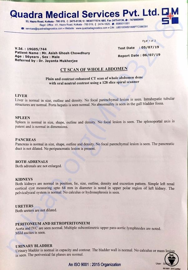 CT Scan report of abdomen