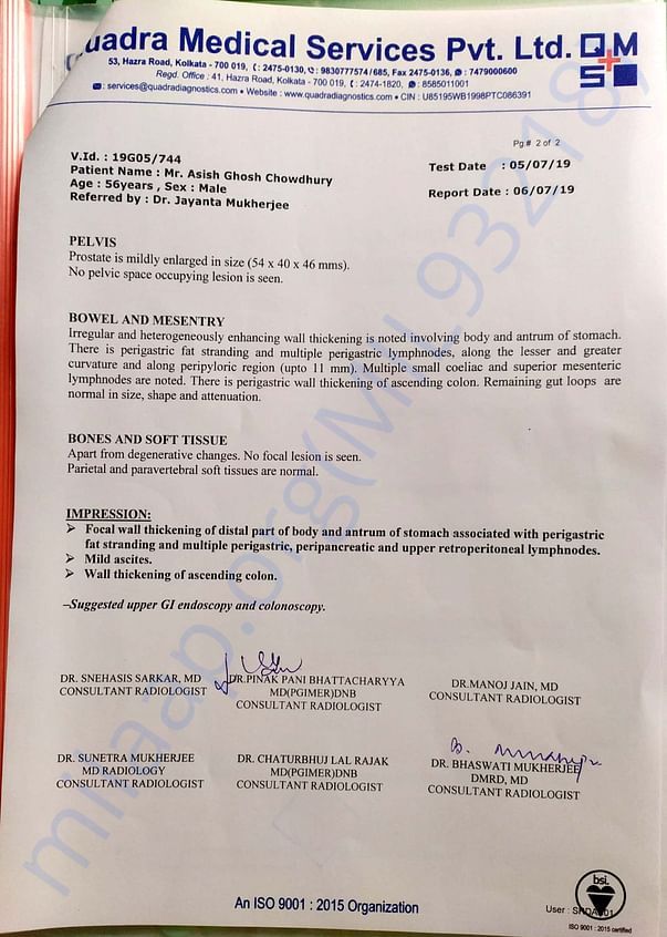 CT Scan report of abdomen