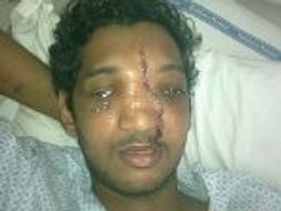 Help Melwyn Recover From His Accident