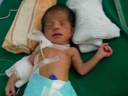 Help Baby Of Divya With Surgery