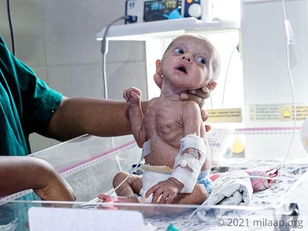 Abu Talha needs your help to undergo his treatment