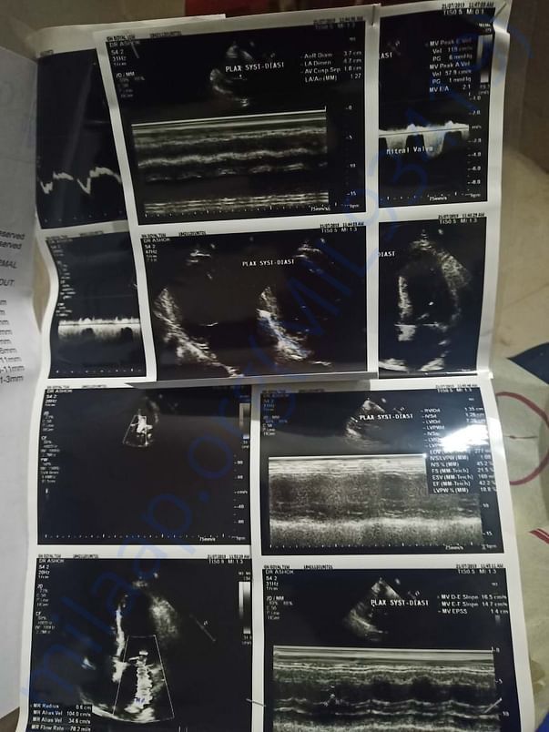 Xray report