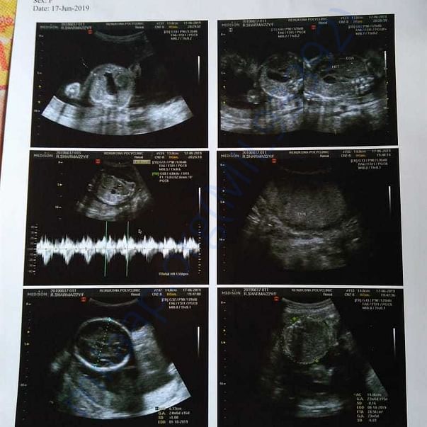 Medical Report