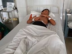 Help 12 Years Old Rudra Recover From A Major Accident
