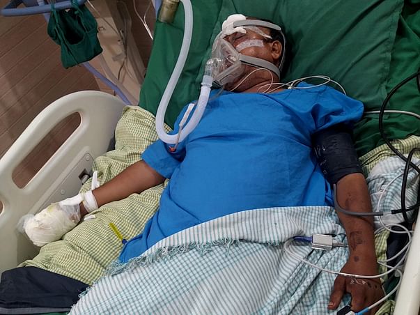 Please Help Yogendra Recover From Traumatic Zygomatic Fracture