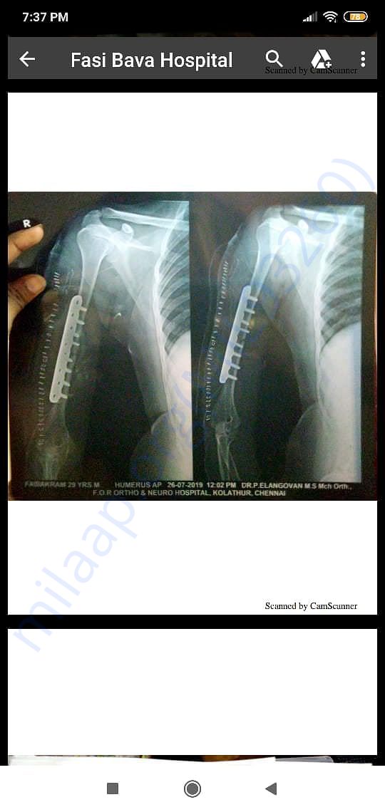 After Operation scan