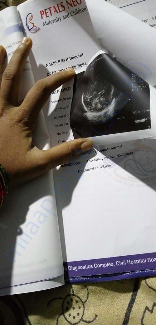 Report of my baby