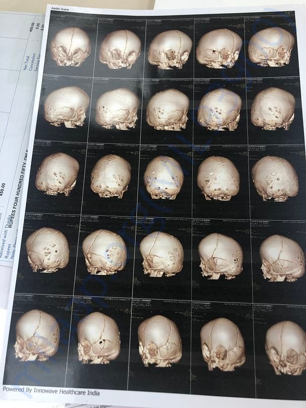 Skull Scan