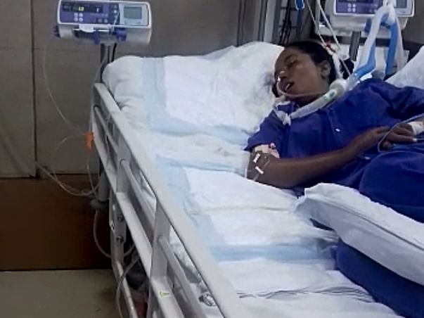 Please Help Nagini Who Is Suffered From Myasthenia Gravis- Urgent.