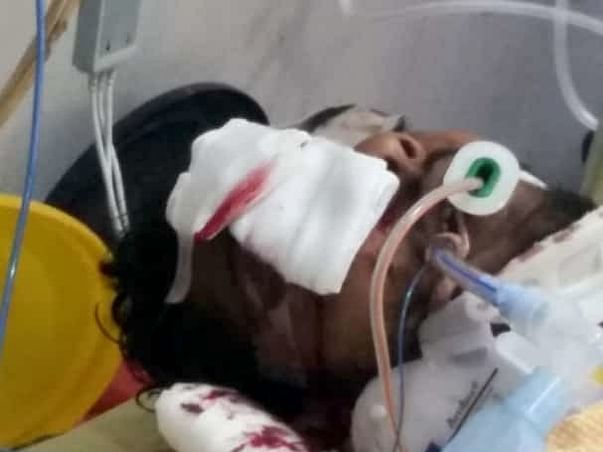 Help My Friend Undergo Brain Surgery And Plastic Surgery To Recover.