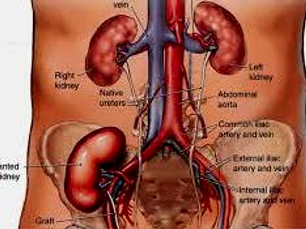 Help Subhash Kumar Choudhary Undergo Kidney Transplant