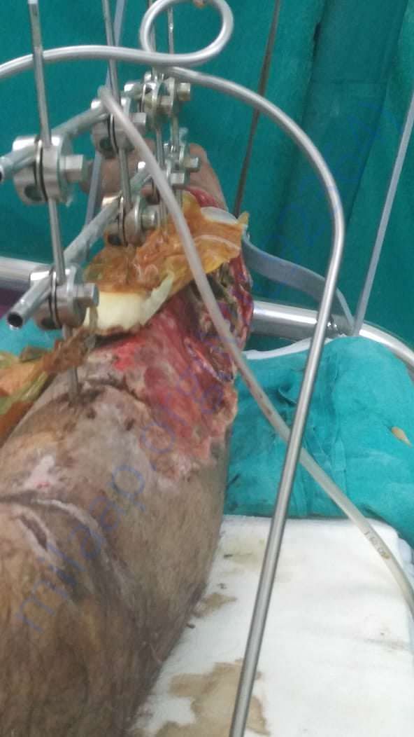 earlier operation pic