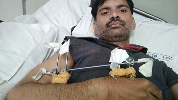 earlier operation pic