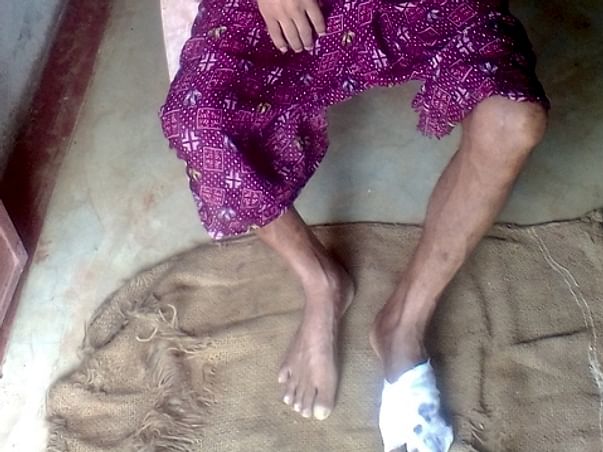 Support My Father Undergo Medical Treatment For His Infected Foot.