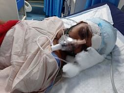 Matloop Head Surgery Needs For Help Urgently