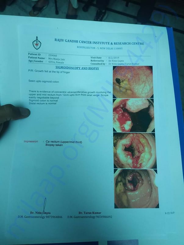Biopsy Report