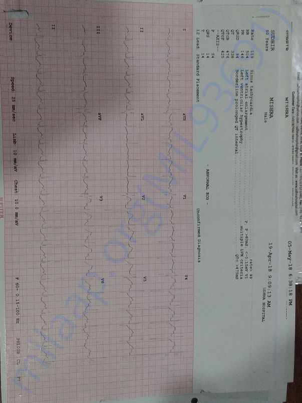 Electrocardiogram