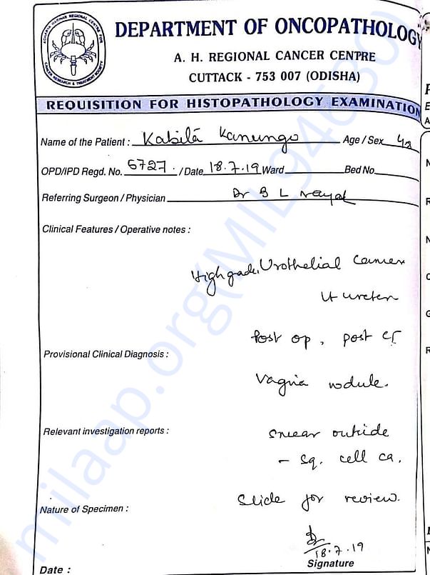 Recent Medical Report Confirming Urothelial Cancer