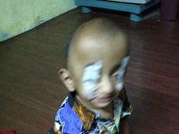 15-month-old Baby Suhail Life Can Be Changed With An Urgent Surgery.