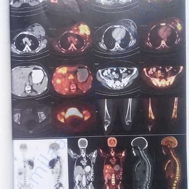 Medical Report