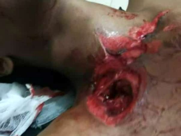 Help Me Recover From Accident
