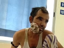 Help Kamrul Fight Mouth Cancer