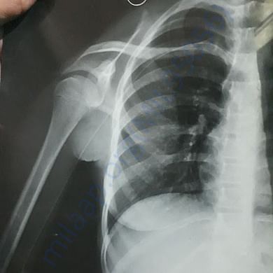 Medical Report