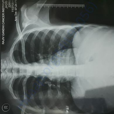 Medical Report