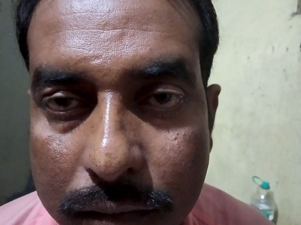 Help Me For Renal transplant
