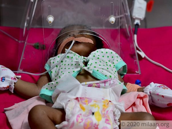 Help Baby Of Gangeswari Undergo Open Heart Surgery