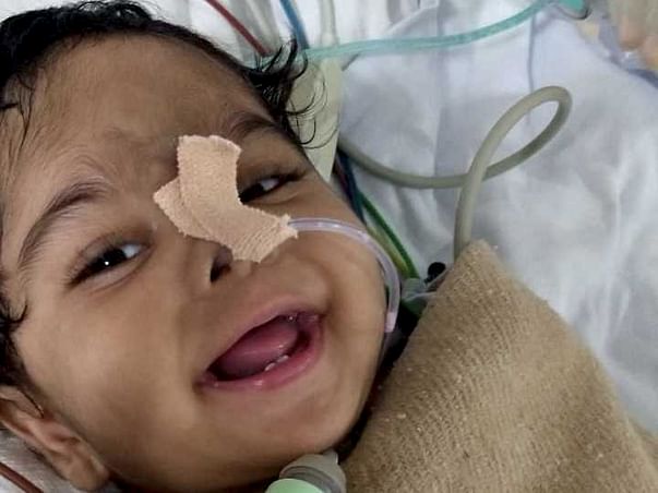 Help Baby Danasri To Overcome Tracheobronchomalacia.