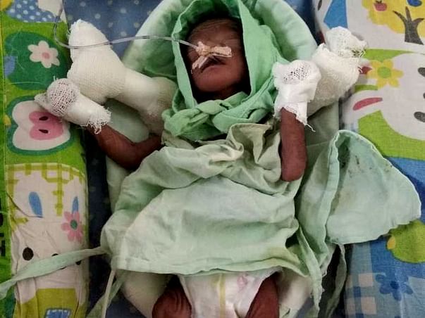 Help Shubhangi to Save 26 weeks Pre-mature Twins! (Only One Survived)