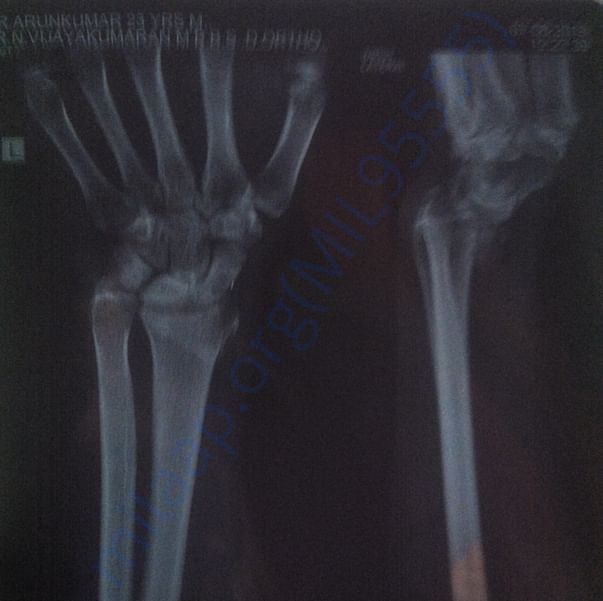 my wrist Xray looking weird.
