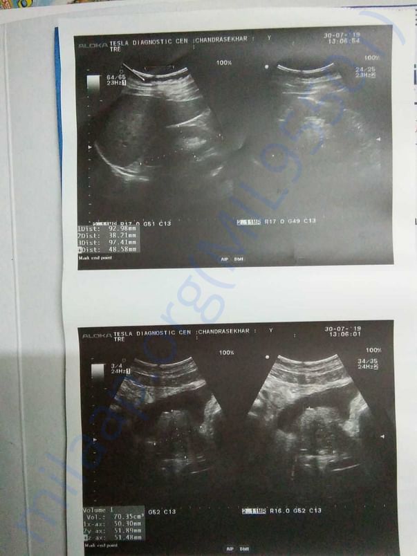 Scan