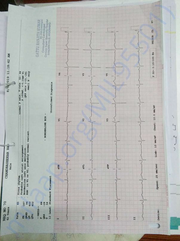 ECG report