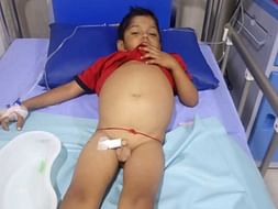 Help My Nephew To Undergo A Liver Transplant