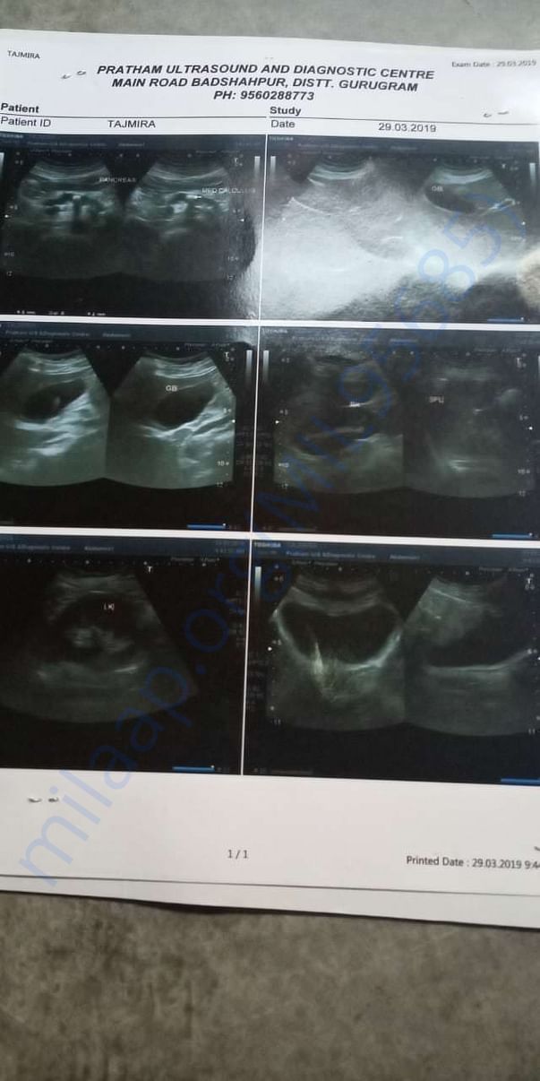 Ultrasound picture