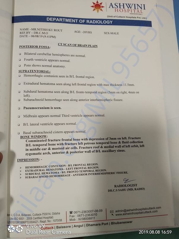 CT Scan Report