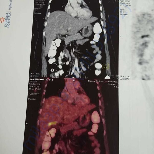 Medical Report