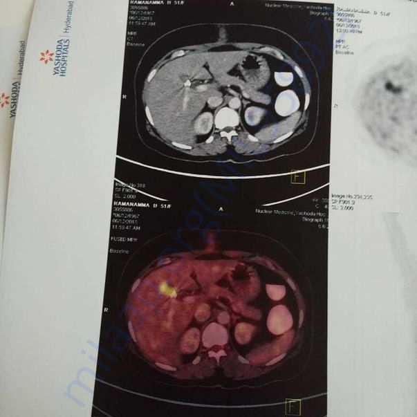 Medical Report
