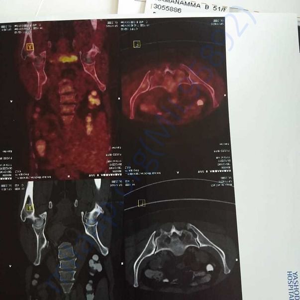 Medical Report