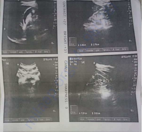Scanning report