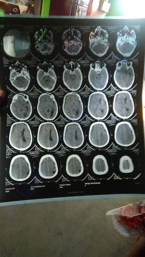 ct scan Report